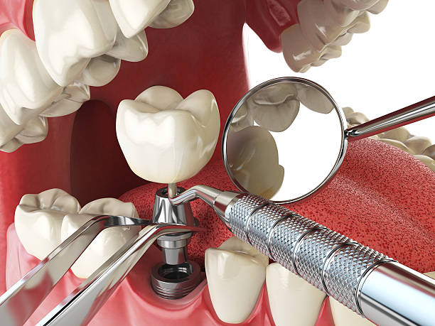 Best Emergency Broken Tooth Repair in Redfield, AR